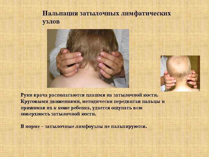 Пальпация затылочных лимфатических узлов Руки врача располагаются плашмя на затылочной кости. Круговыми движениями, методически