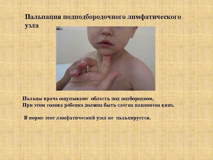 Пальпация подподбородочного лимфатического узла Пальцы врача ощупывают область подбородком, При этом голова ребенка должна