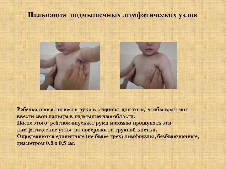 Пальпация подмышечных лимфатических узлов Ребенка просят отвести руки в стороны для того, чтобы врач