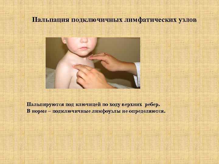 Пальпация подключичных лимфатических узлов Пальпируются под ключицей по ходу верхних ребер. В норме –