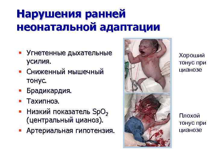 Нарушения ранней неонатальной адаптации § Угнетенные дыхательные усилия. § Сниженный мышечный тонус. § Брадикардия.