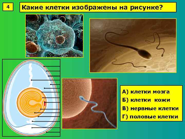 4 Какие клетки изображены на рисунке? А) клетки мозга Б) клетки кожи В) нервные