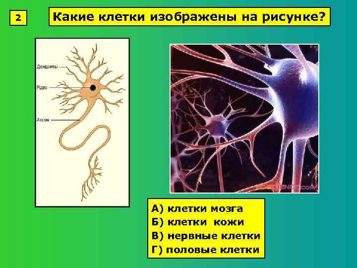 2 Какие клетки изображены на рисунке? А) клетки мозга Б) клетки кожи В) нервные