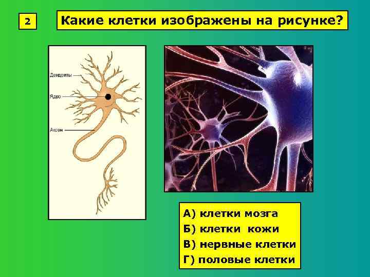 2 Какие клетки изображены на рисунке? А) клетки мозга Б) клетки кожи В) нервные