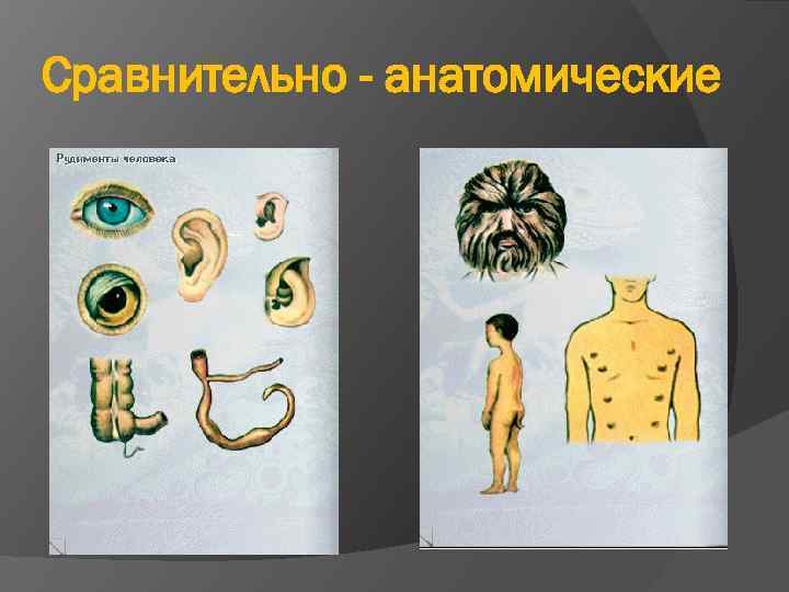 Сравнительно - анатомические 