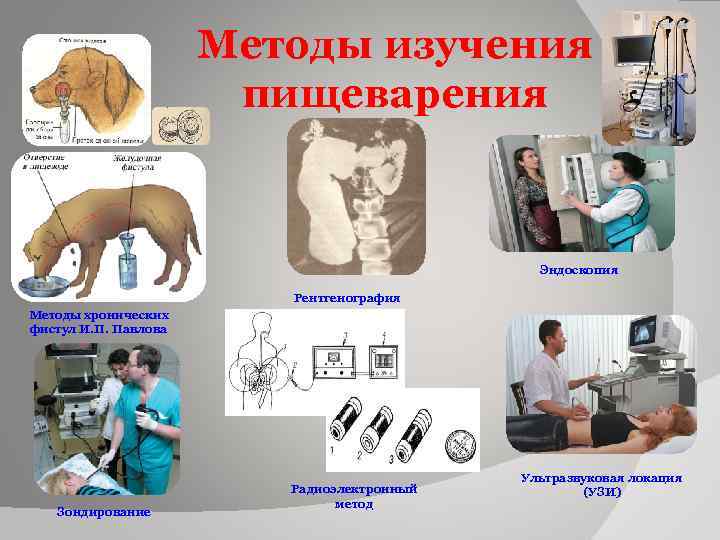 Методы изучения пищеварения Эндоскопия Рентгенография Методы хронических фистул И. П. Павлова Зондирование Радиоэлектронный метод