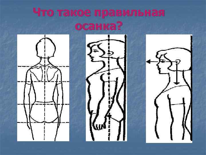 Что такое правильная осанка? 