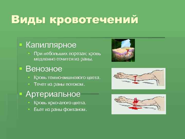Виды кровотечений § Капиллярное • При небольших порезах; кровь медленно сочится из раны. §