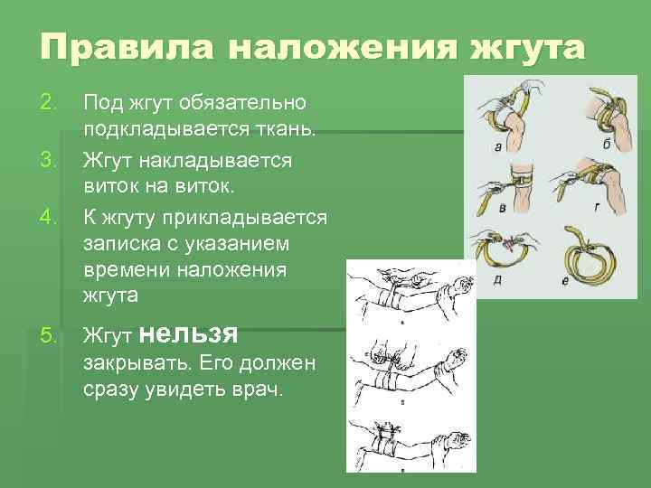 Правила наложения жгута 2. 3. 4. 5. Под жгут обязательно подкладывается ткань. Жгут накладывается