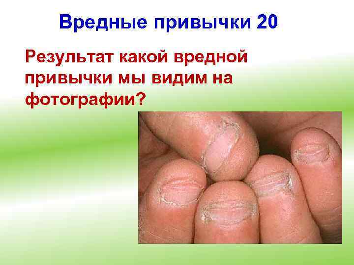 Вредные привычки 20 Результат какой вредной привычки мы видим на фотографии? 