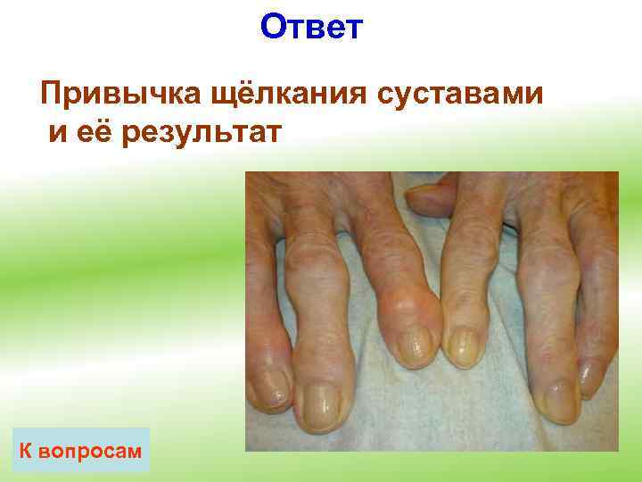 Ответ Привычка щёлкания суставами и её результат К вопросам 