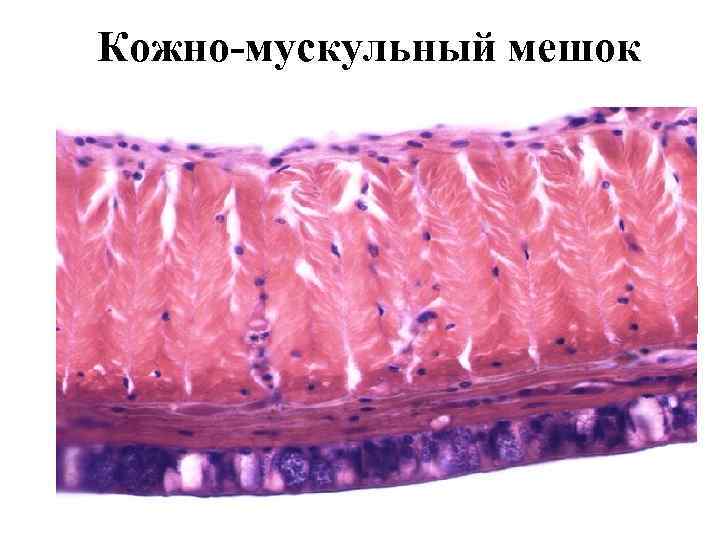 Кожно-мускульный мешок кутикула кожный эпителий продольные мышцы кольцевые мышцы 