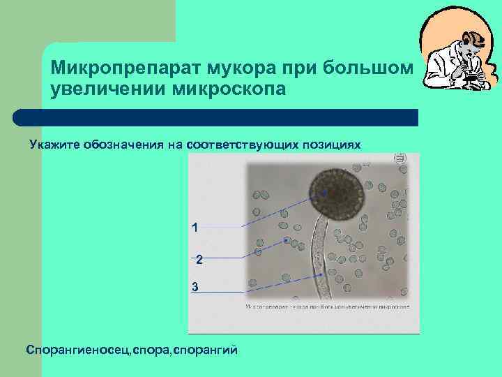 Микропрепарат мукора при большом увеличении микроскопа Укажите обозначения на соответствующих позициях 1 2 3