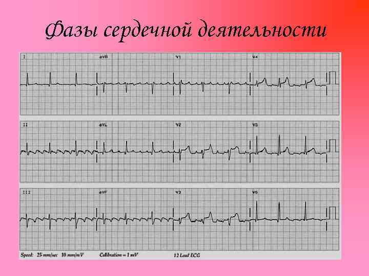 Фазы сердечной деятельности 