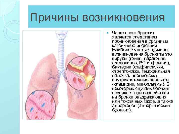 Причины возникновения Чаще всего бронхит является следствием проникновения в организм какой-либо инфекции. Наиболее частые