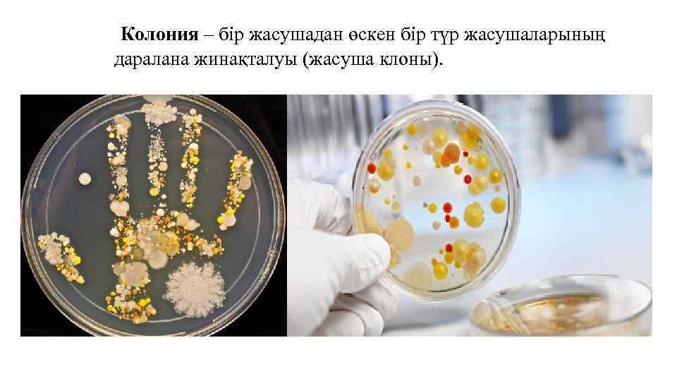  Колония – бір жасушадан өскен бір түр жасушаларының даралана жинақталуы (жасуша клоны). 