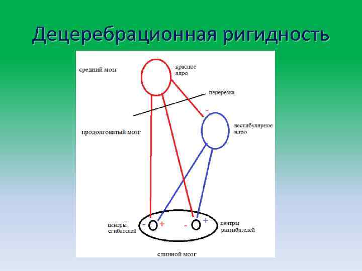 Децеребрационная ригидность 