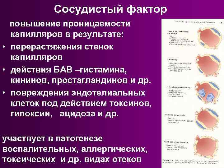 Факторы повышающие проницаемость сосудов. Повышение проницаемости капилляров. Повышение проницаемости стенок сосудов. Повышенип проницаемости со.