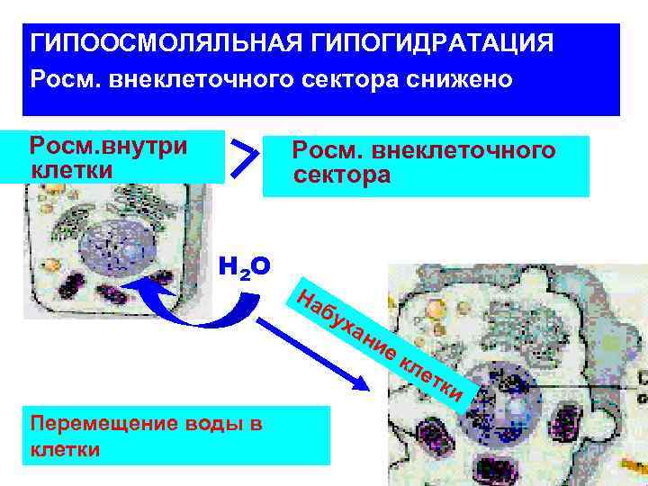 ГИПООСМОЛЯЛЬНАЯ ГИПОГИДРАТАЦИЯ Росм. внеклеточного сектора снижено Росм. внутри клетки Росм. внеклеточного сектора Н 2