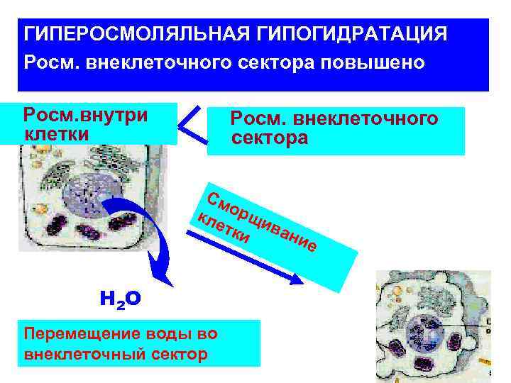 ГИПЕРОСМОЛЯЛЬНАЯ ГИПОГИДРАТАЦИЯ Росм. внеклеточного сектора повышено Росм. внутри клетки Росм. внеклеточного сектора См кле