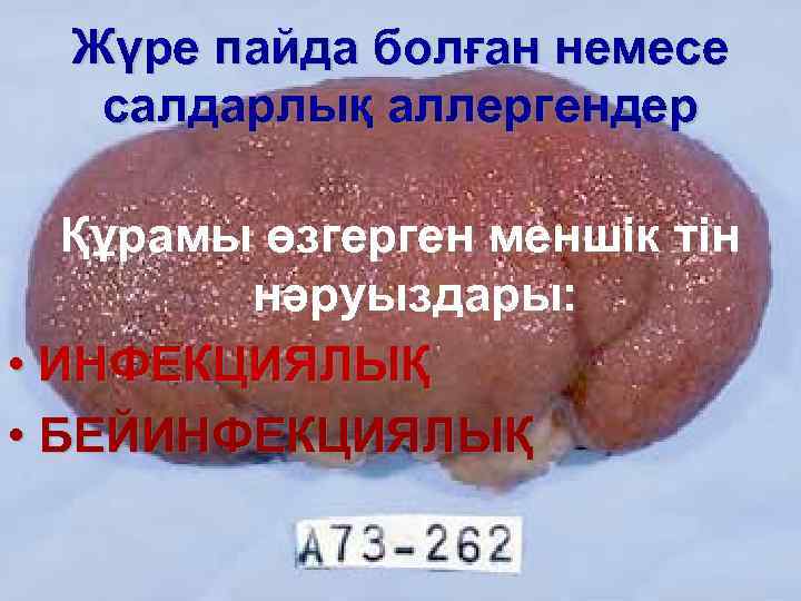 Жүре пайда болған немесе салдарлық аллергендер Құрамы өзгерген меншік тін нәруыздары: • ИНФЕКЦИЯЛЫҚ •