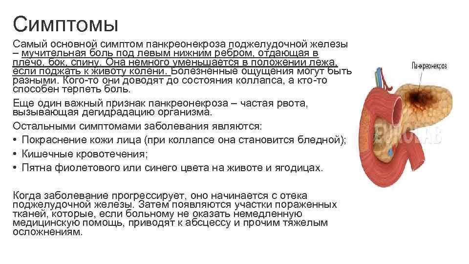 Симптомы Самый основной симптом панкреонекроза поджелудочной железы – мучительная боль под левым нижним ребром,