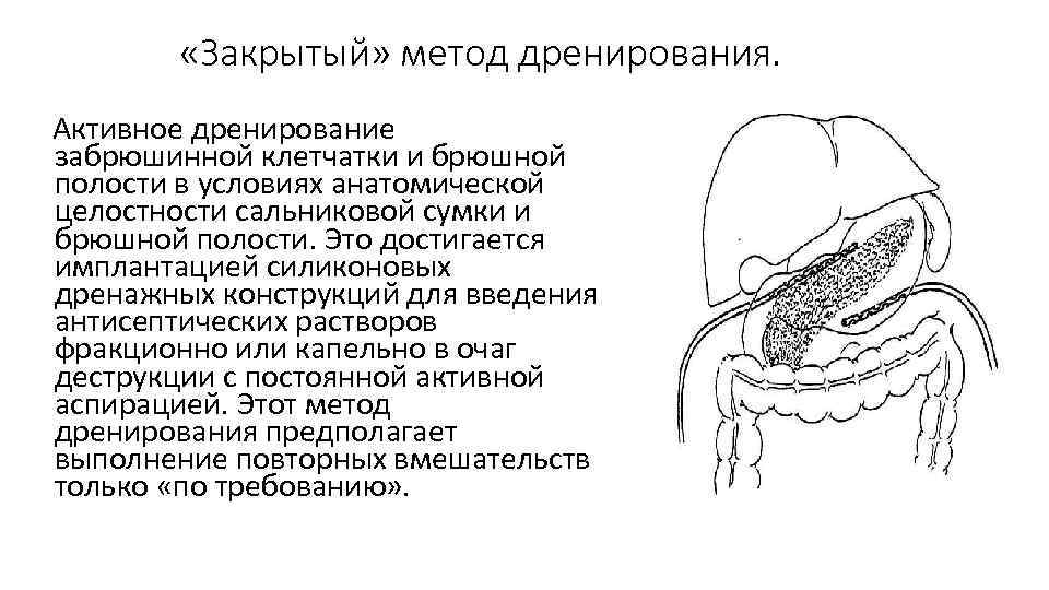 Панкреонекроз код по мкб 10