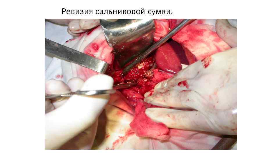 Ревизия сальниковой сумки. 