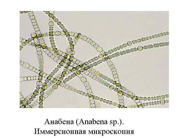 Анабена (Anabena sp. ). Иммерсионная микроскопия 