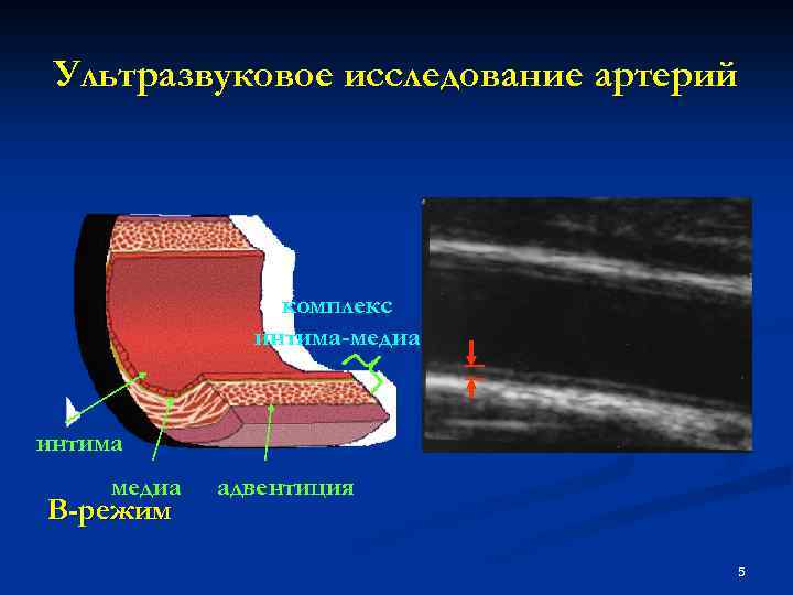 Адвентиция это