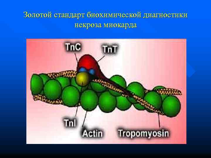 Золотой стандарт биохимической диагностики некроза миокарда 