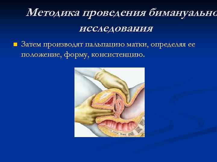 Методика проведения бимануально исследования. n Затем производят пальпацию матки, определяя ее положение, форму, консистенцию.