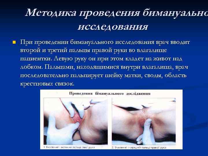 Методика проведения бимануально исследования n При проведении бимануального исследования врач вводит второй и третий