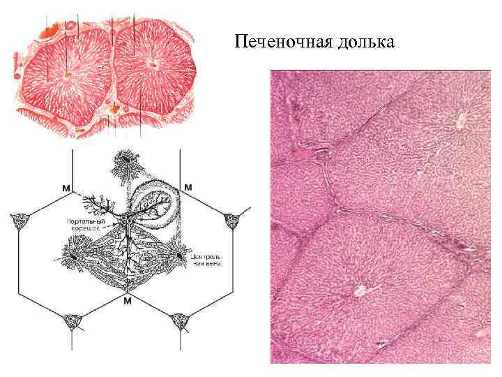 Печеночная долька 