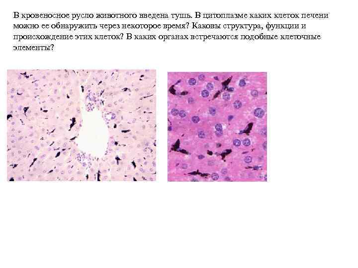 В кровеносное русло животного введена тушь. В цитоплазме каких клеток печени можно ее обнаружить