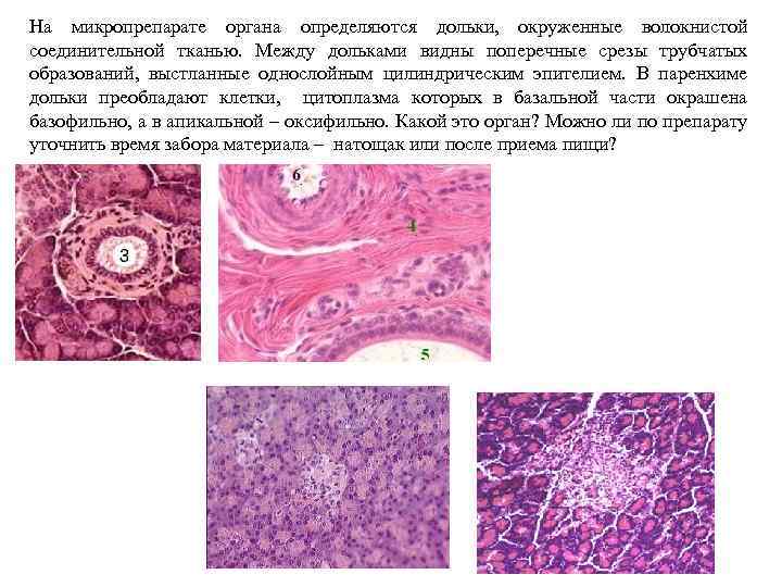 На микропрепарате органа определяются дольки, окруженные волокнистой соединительной тканью. Между дольками видны поперечные срезы