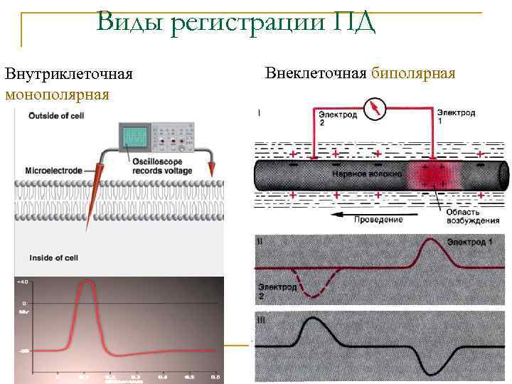 Виды регистрации ПД Внутриклеточная монополярная Внеклеточная биполярная 