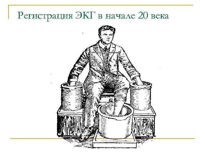 Регистрация ЭКГ в начале 20 века 