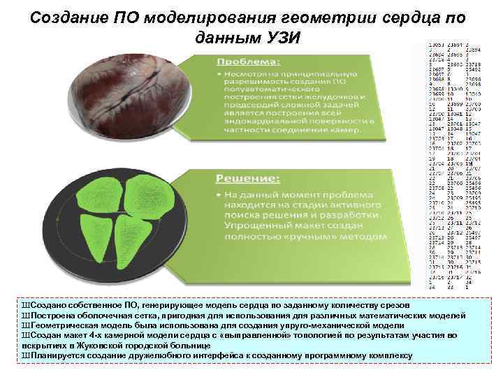 Создание ПО моделирования геометрии сердца по данным УЗИ ШСоздано собственное ПО, генерирующее модель сердца