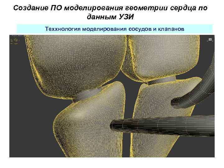 Создание ПО моделирования геометрии сердца по данным УЗИ Теххнология моделирования сосудов и клапанов 