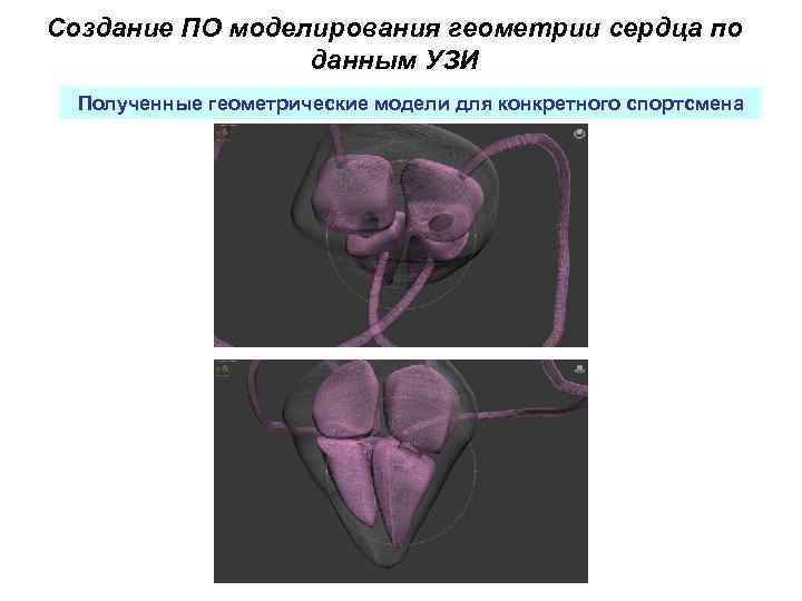 Создание ПО моделирования геометрии сердца по данным УЗИ Полученные геометрические модели для конкретного спортсмена
