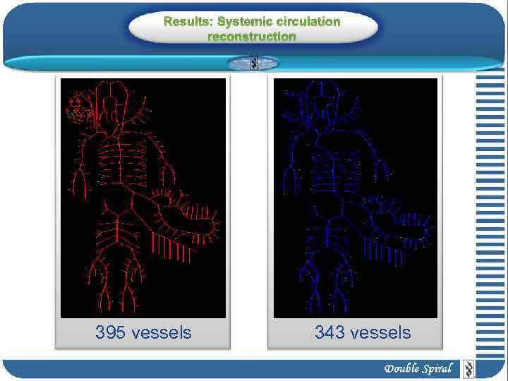 Results: Systemic circulation reconstruction 395 vessels 343 vessels 