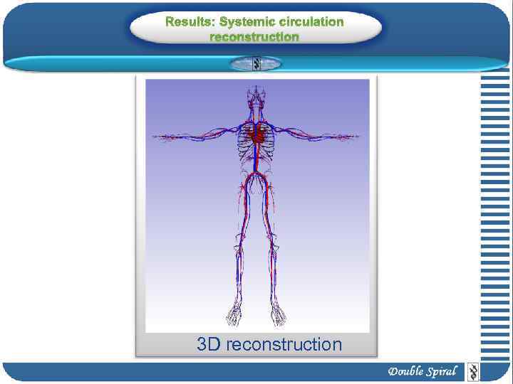 Results: Systemic circulation reconstruction 3 D reconstruction 