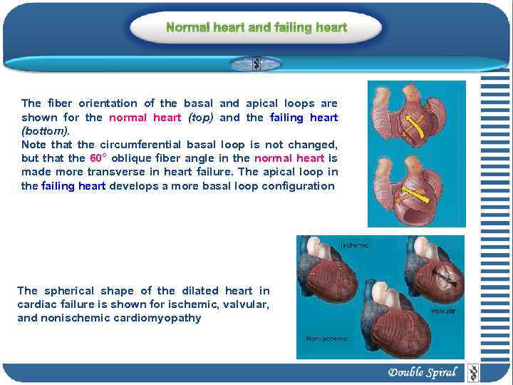 Normal heart and failing heart The fiber orientation of the basal and apical loops