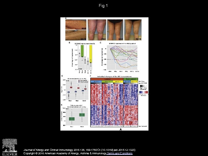 Fig 1 Journal of Allergy and Clinical Immunology 2016 138, 169 -178 DOI: (10.