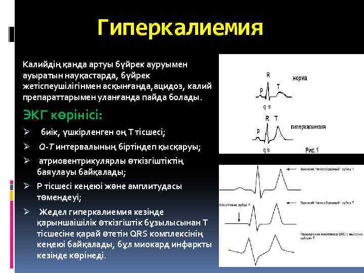 Гиперкалиемия Калийдің қанда артуы бүйрек ауруымен ауыратын науқастарда, бүйрек жетіспеушілігінмен асқынғанда, ацидоз, калий препараттарымен