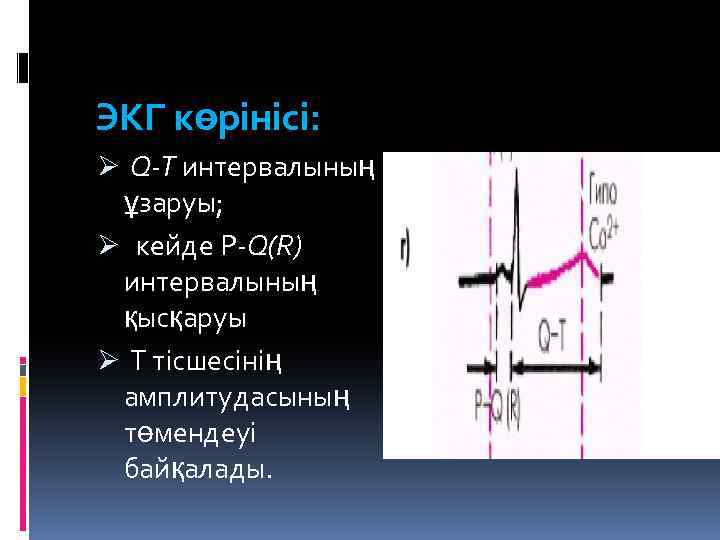 ЭКГ көрінісі: Ø Q-T интервалының ұзаруы; Ø кейде Р-Q(R) интервалының қысқаруы Ø Т тісшесінің