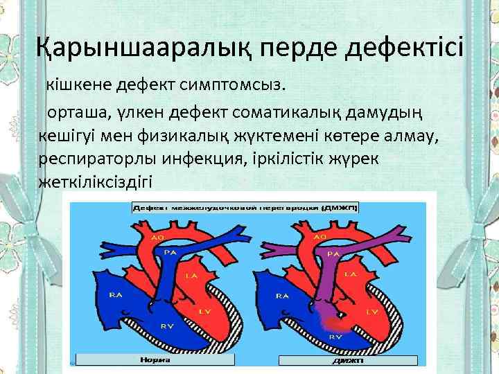 Қарыншааралық перде дефектісі кішкене дефект симптомсыз. орташа, үлкен дефект соматикалық дамудың кешігуі мен физикалық