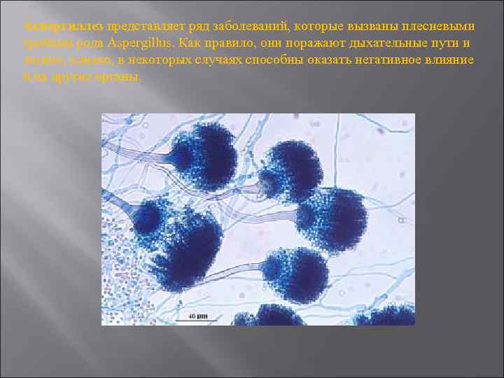 Аспергиллез представляет ряд заболеваний, которые вызваны плесневыми грибами рода Aspergillus. Как правило, они поражают