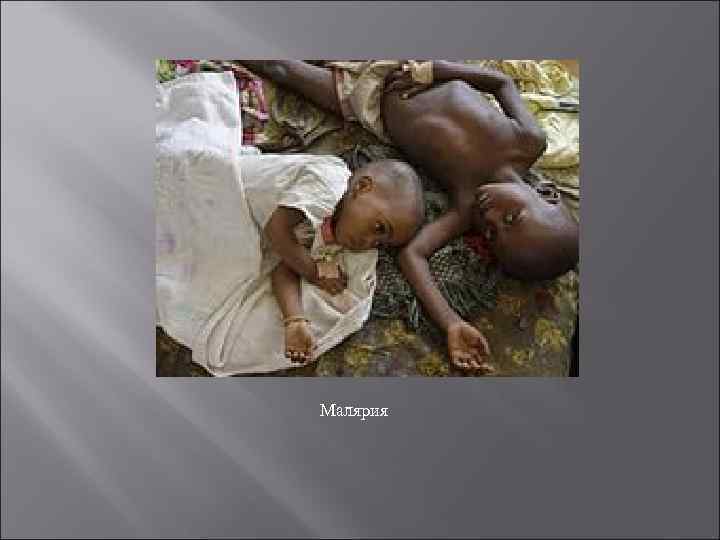 Малярия 